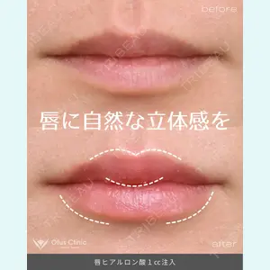 症例