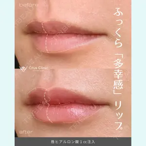 症例