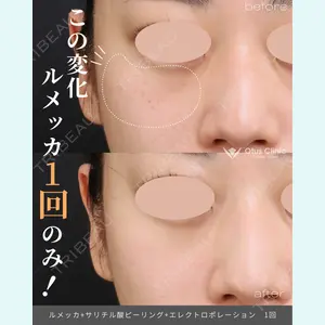 症例