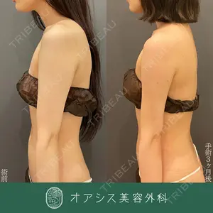 オアシス美容外科 遠藤 剛史医師の症例