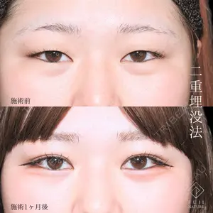 症例