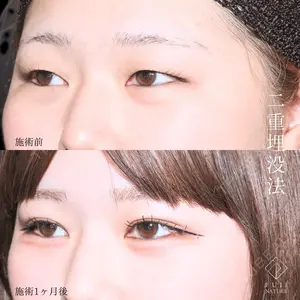 症例