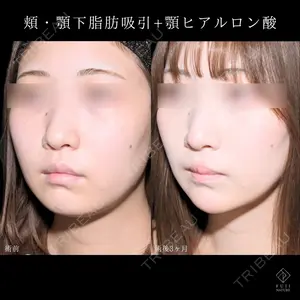 症例