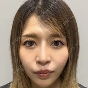 Days Beauty Clinicの症例
