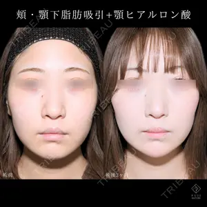 症例