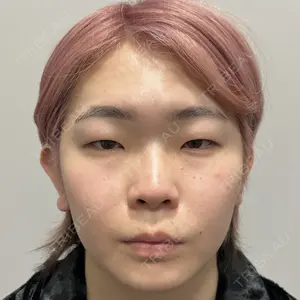 Days Beauty Clinicの症例