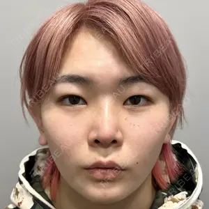 Days Beauty Clinicの症例