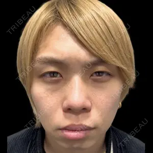 Days Beauty Clinicの症例