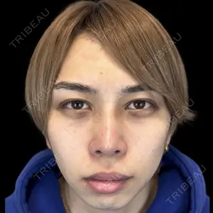Days Beauty Clinicの症例