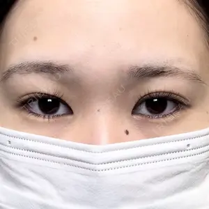Days Beauty Clinicの症例