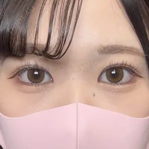 Days Beauty Clinicの症例