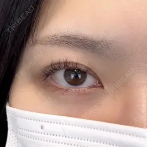 Days Beauty Clinicの症例