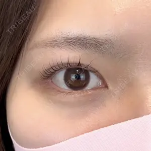 Days Beauty Clinicの症例