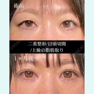 HAAB BEAUTY CLINIC 名古屋院 丸山 舜大医師の症例