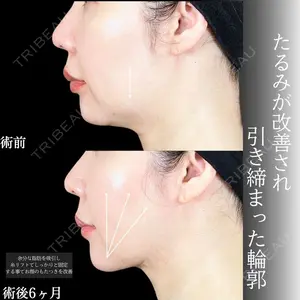 アリエル美容クリニック 大宮院 鈴木　桂介医師の症例