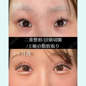 HAAB BEAUTY CLINIC 名古屋院 丸山 舜大医師の症例
