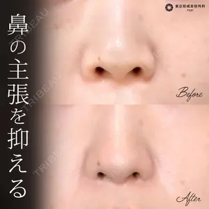 症例