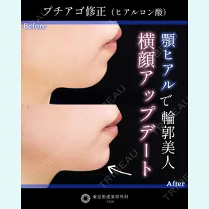症例