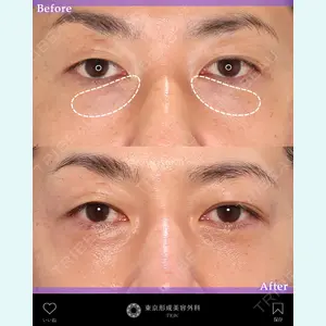 東京形成美容外科 銀座院 中尾 真紀医師の症例