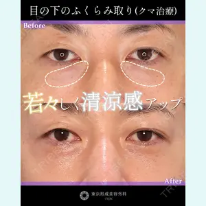 東京形成美容外科 銀座院 中尾 真紀医師の症例
