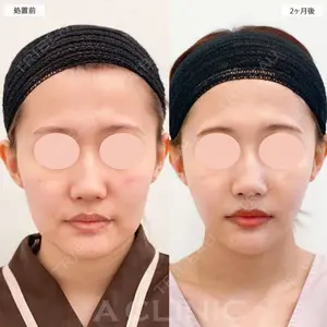 症例