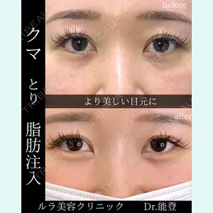 症例