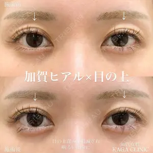 症例