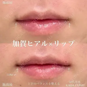症例