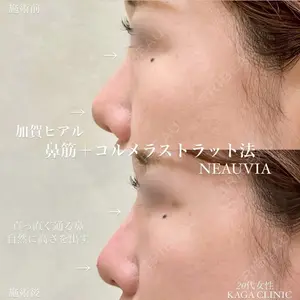 症例