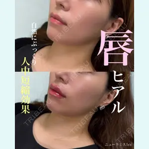 症例