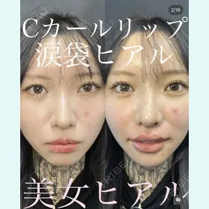 症例