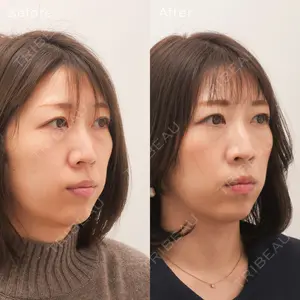 症例