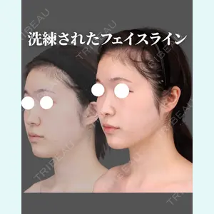 Casa de GRACIA GINZA 【カーサデグラシアギンザ】 吉田 直樹医師の症例