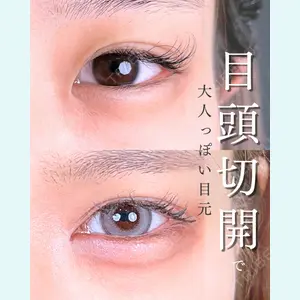 東京シンデレラ美容外科 池袋院 山本 紘子医師の症例