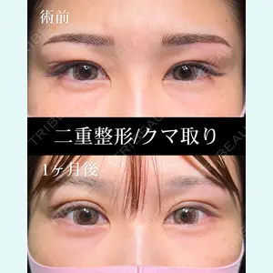 症例