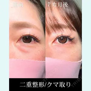 症例