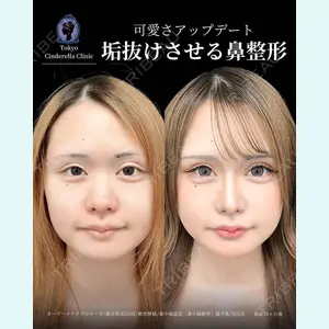 症例