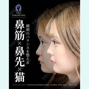 症例