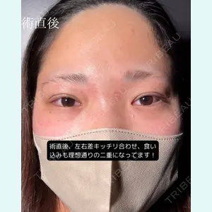 症例