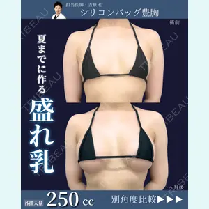 症例