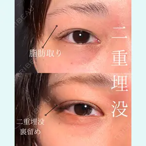 症例