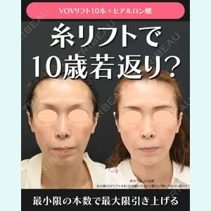 湘南美容クリニック 川崎院 伊藤 賀敏医師の症例