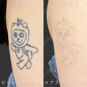 症例