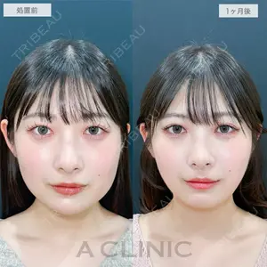A CLINIC（エークリニック） 銀座院 長谷川 光医師の症例
