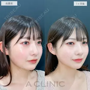 A CLINIC（エークリニック） 銀座院 長谷川 光医師の症例