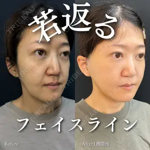 症例