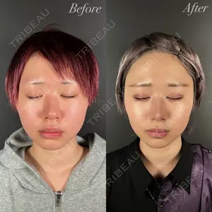 R Beauty CLINIC 大阪院 小池 泰弘医師の症例