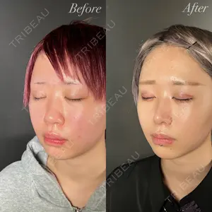 R Beauty CLINIC 銀座院の症例