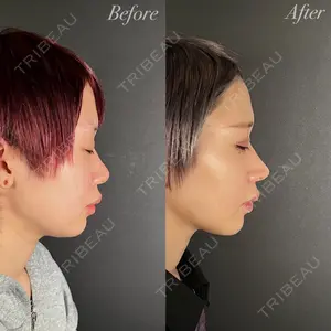 R Beauty CLINIC 大阪院 小池 泰弘医師の症例