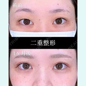 HAAB×DREAM BEAUTY CLINIC 大阪梅田院 柏木 太雅医師の症例